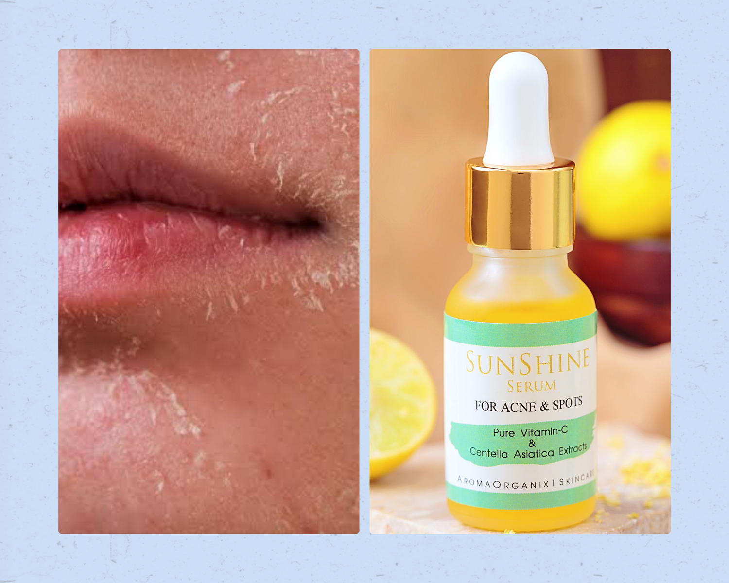 dryskinserum